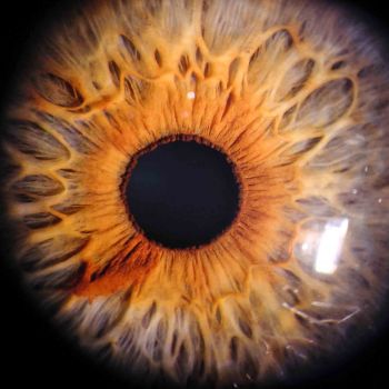 Iris Auge 1